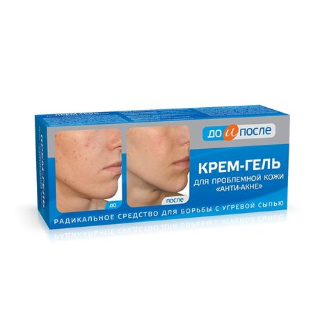 Tvins Tek До и После Анти-акне Крем–гел за проблемна кожа x50 мл